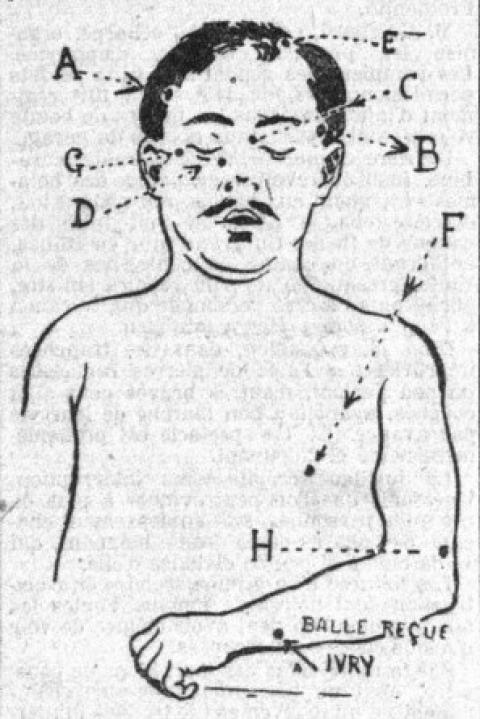 Croquis des blessures de Bonnot, Le Petit Parisien, 29 avril 1912 - source : RetroNews-BnF
